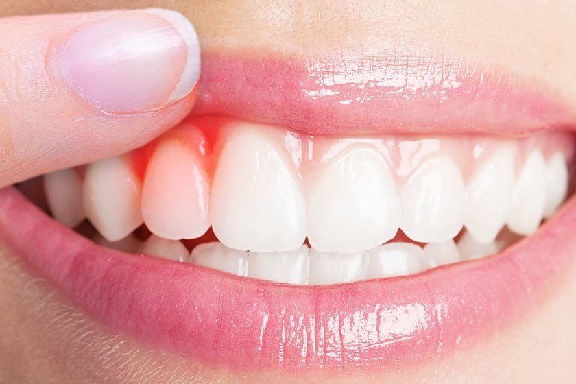 gum treatment