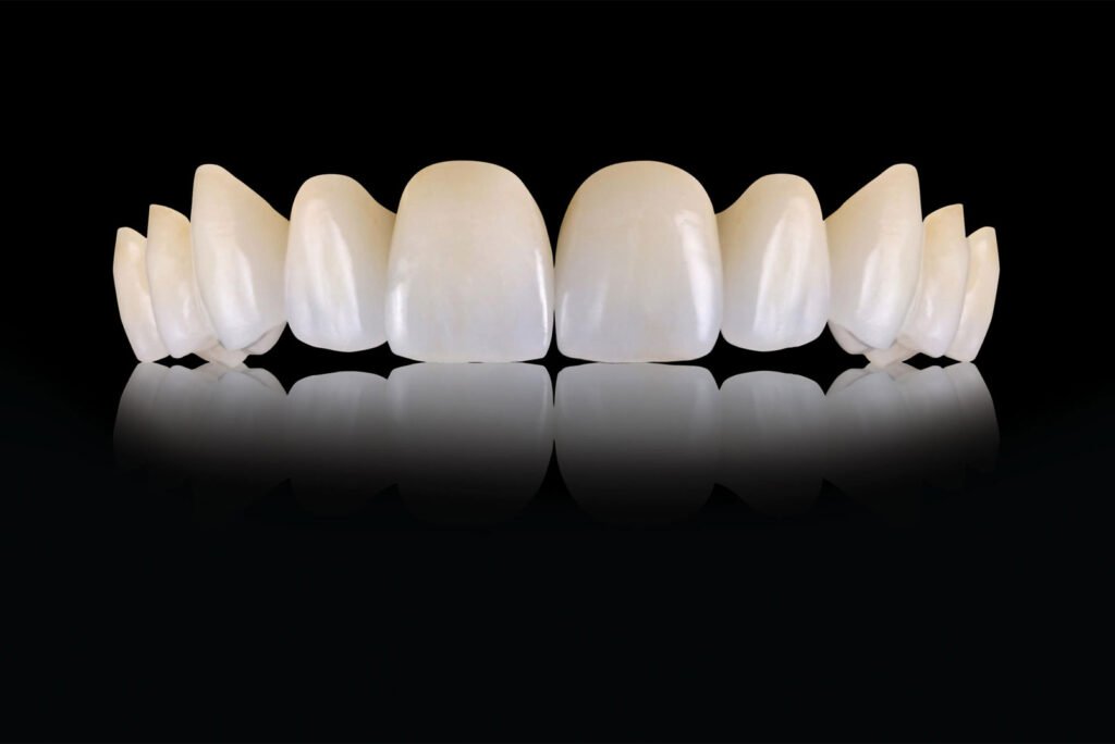 emax crown