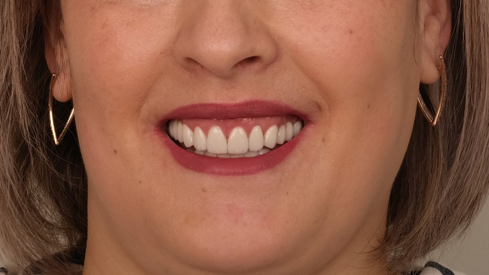 patient after